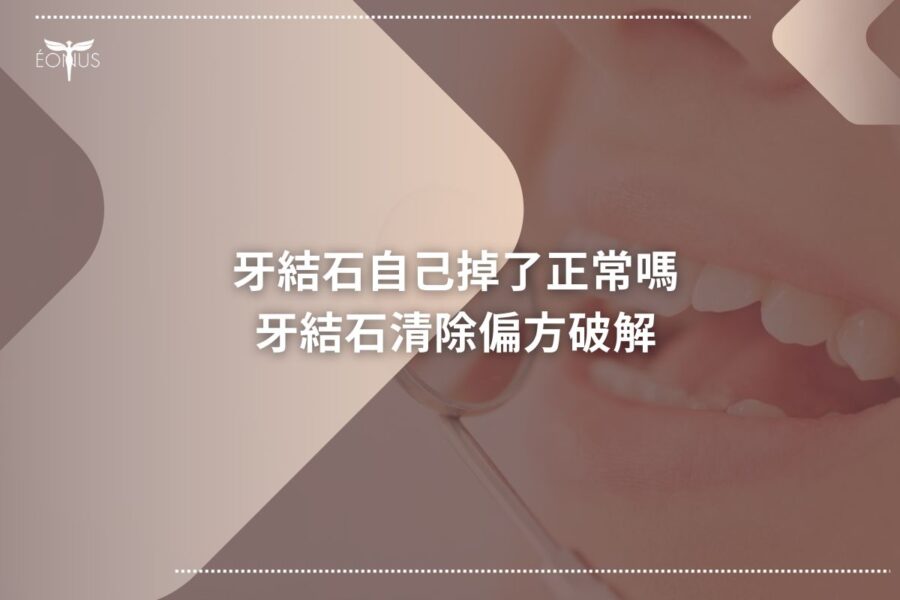 根管治療價錢 (2)