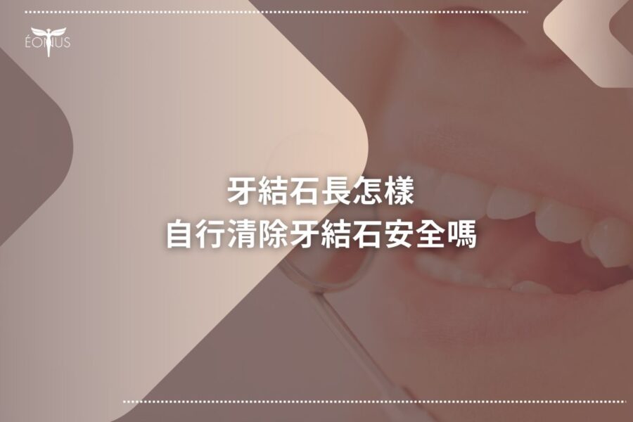 根管治療價錢 (3)